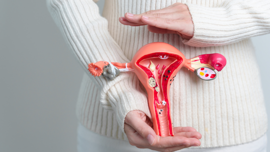 Endometrioza: Niewidzialna Choroba, Która Dotyka Miliony Kobiet
