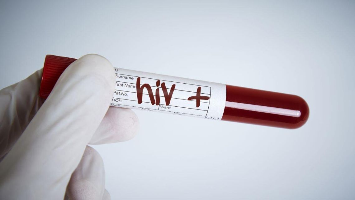 Coraz więcej przypadków HIV w Polsce